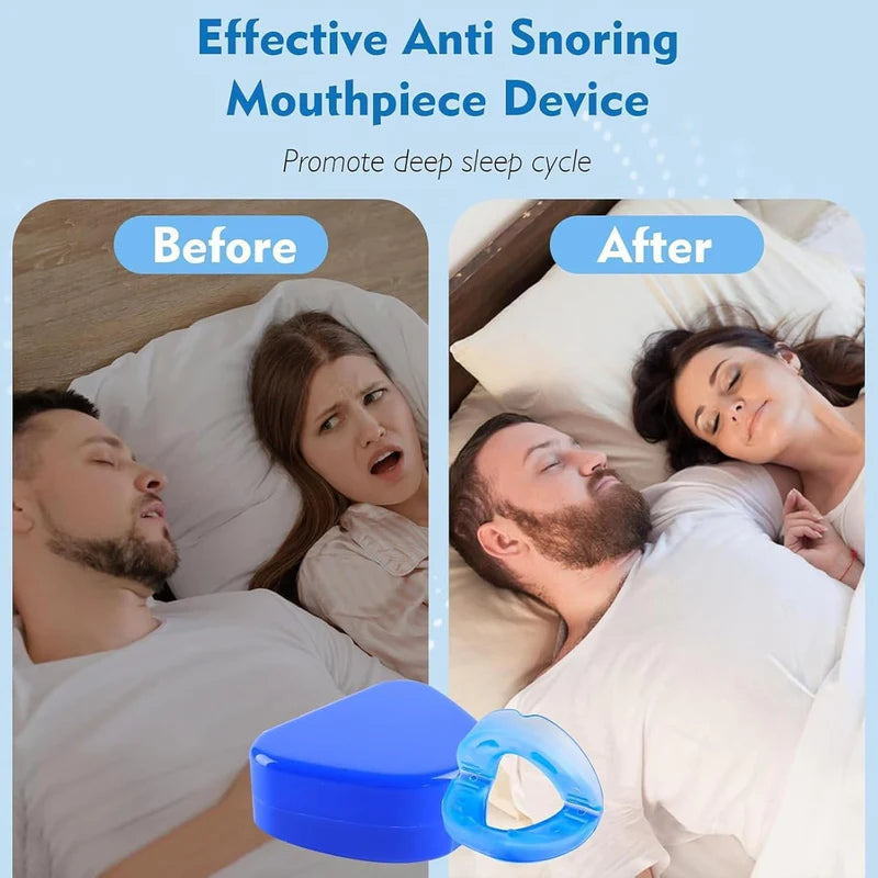 Anti Snore Mouthpiece – Comfortable Sleep & Breathing Support